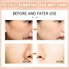 VC Whitening Instant Blemish Pen Remove Melasma Pigment Melanin Dark Spot Gel Freckle Cream Face Brighten Skin Repair Anti Aging